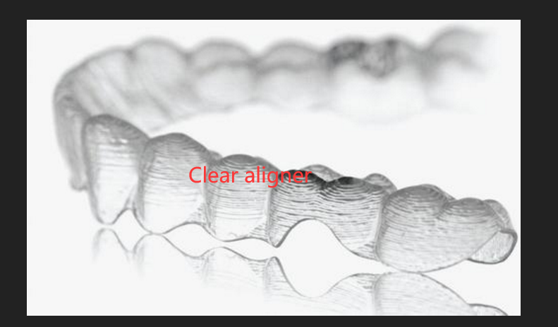 Clear aligner